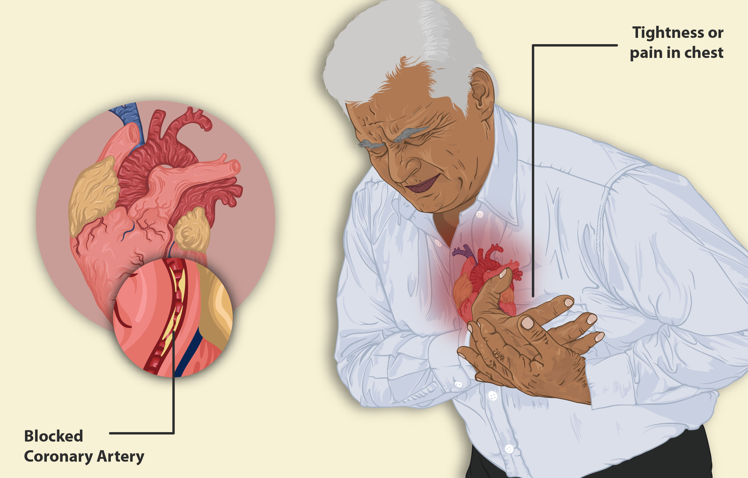 Heart Disease मानव रोग